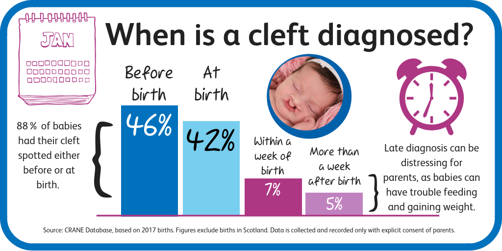 cleft lip statistics