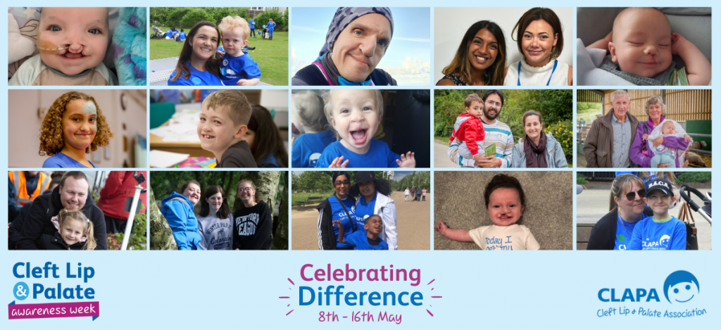 A pale blue background with a collage of 15 different photos, showing members of the CLAPA community smiling. Below is the CLAPA Awareness Week logo, CLAPA blue logo, and text reading 'Celebrating Difference 8th - 16th May'