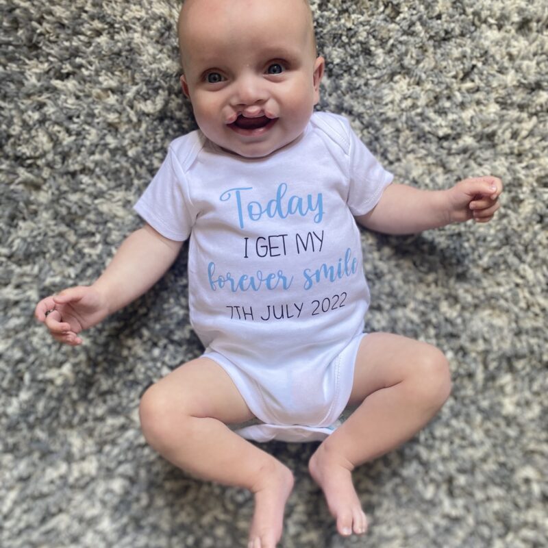 Albie on the day of his operation