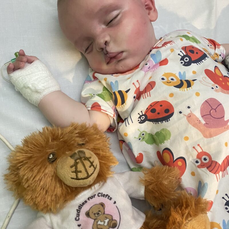 Albie right after his operation