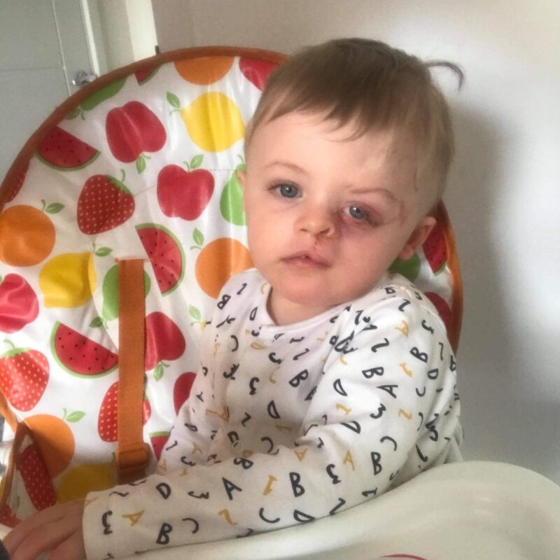 Charlie after his operation