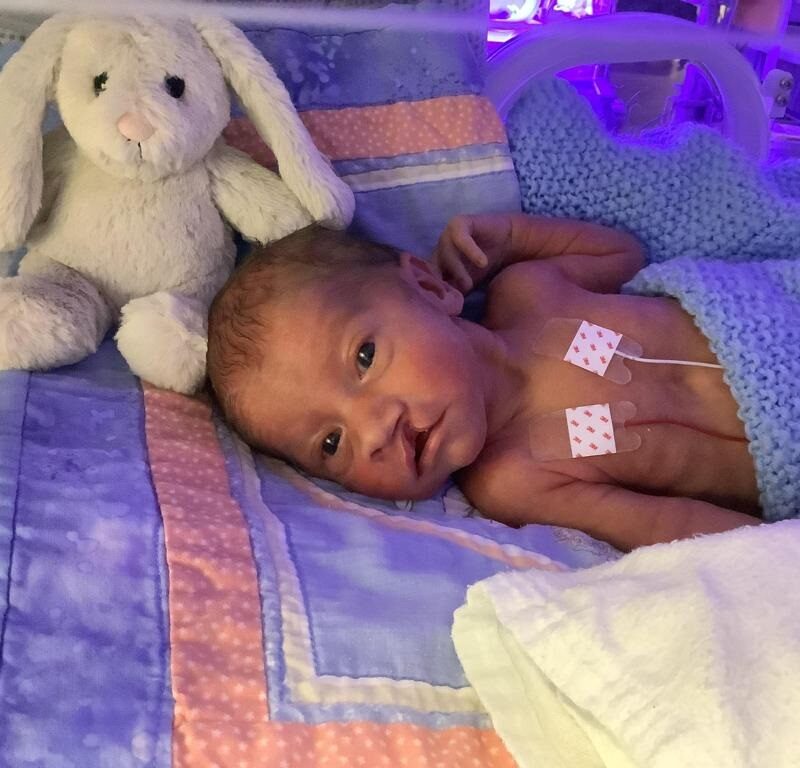 Daniel shortly after birth at 32 weeks