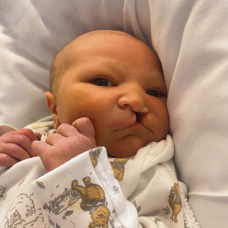 Ffredi shortly after birth