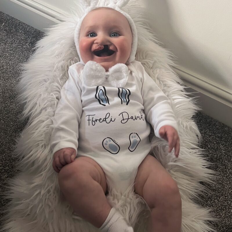 Ffredi at Easter before his operation