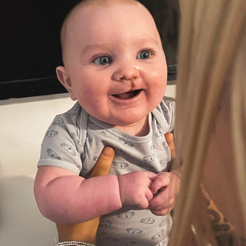 Ffredi after his operation