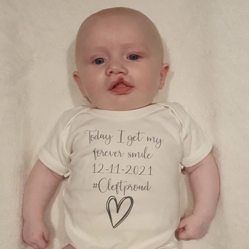 Paudie before his operation