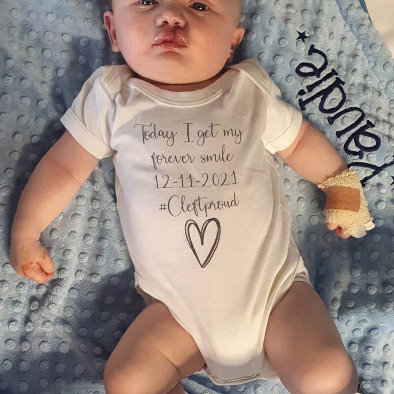 Paudie right after his operation