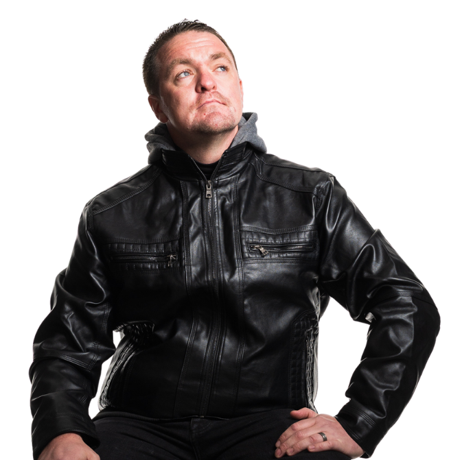 A man is wearing a leather jacket and looking away from the camera. He has a repaired cleft.