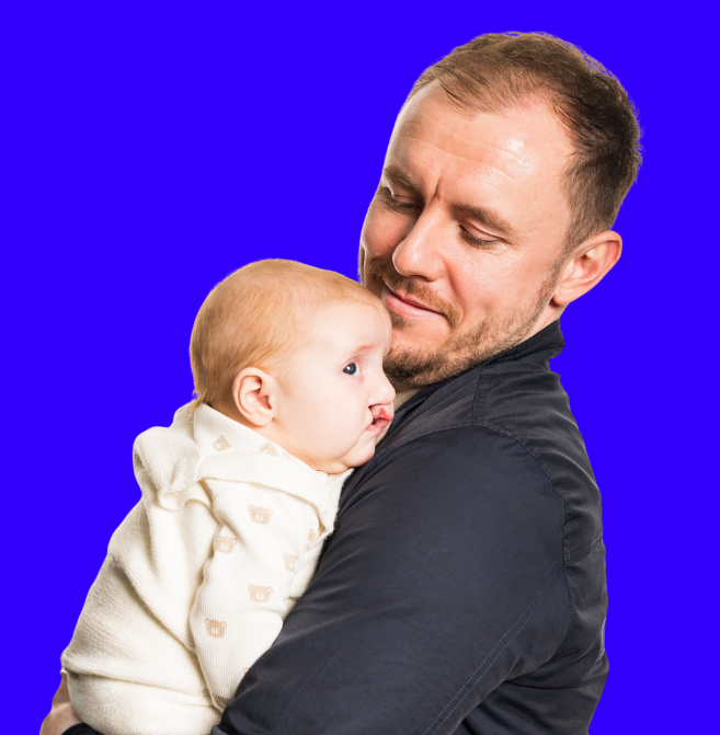 A man holds a baby with an unrepaired cleft lip